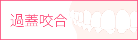 過蓋咬合の矯正治療の抜歯について