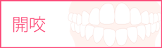 開咬の矯正治療の抜歯について